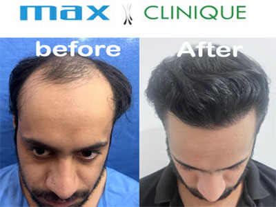 maxclinique.com