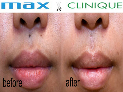 maxclinique.com